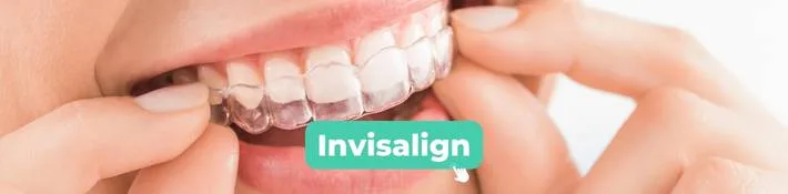 Aparelho Invisalign Paulínia